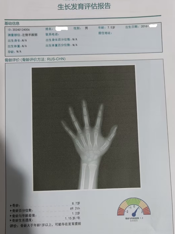 骨齡和身高有什么關系？每個孩子都有必要檢測嗎？